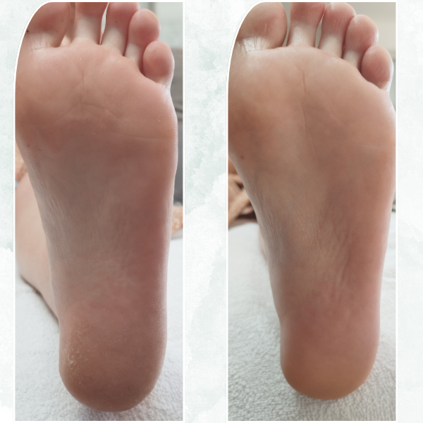 pieds doux apres soin anti-callosités pieds